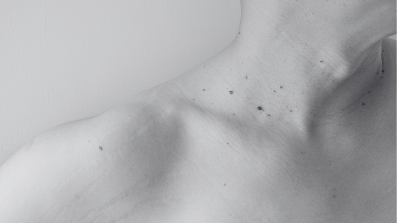 Skin Tightening(Large Area)